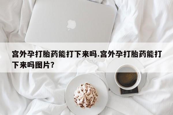 米索前列醇在线下单宫外孕打胎药能打下来吗.宫外孕打胎药能打下来吗图片？